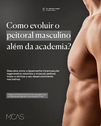 Peça produzida pela V2 Data Soluções